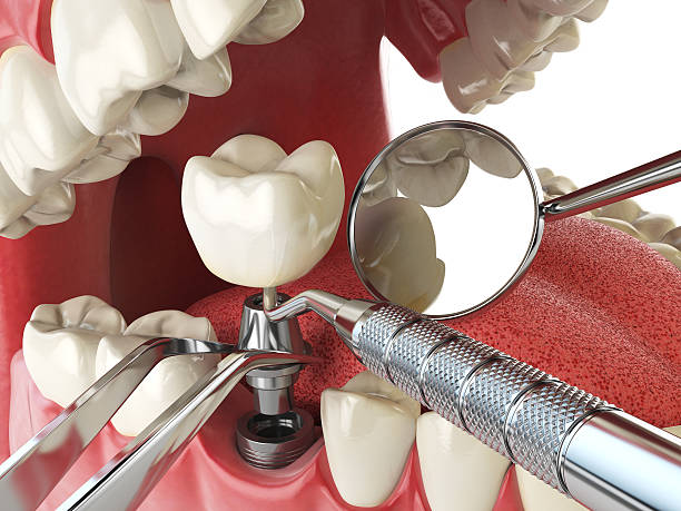 Best Root Canal Emergency Dentist  in Commerce, OK